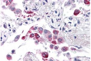Human Lung: Formalin-Fixed, Paraffin-Embedded (FFPE) (EFHD1 抗体  (N-Term))
