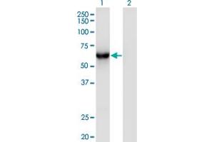 Western Blot analysis of CAMKK1 expression in transfected 293T cell line by CAMKK1 monoclonal antibody (M05), clone 3B4.
