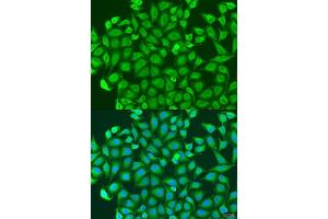 Immunofluorescence analysis of U2OS cells using PCDH antibody (ABIN6128584, ABIN6145301, ABIN6145302 and ABIN6220787) at dilution of 1:100. (PCDHA6 抗体  (AA 1-230))