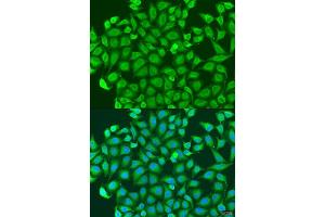 Immunofluorescence analysis of U2OS cells using PCDH antibody (ABIN6128584, ABIN6145301, ABIN6145302 and ABIN6220787) at dilution of 1:100. (PCDHA6 抗体  (AA 1-230))