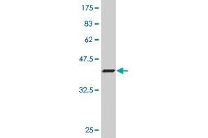 Western Blot detection against Immunogen (37. (ZEB2 抗体  (AA 1115-1214))