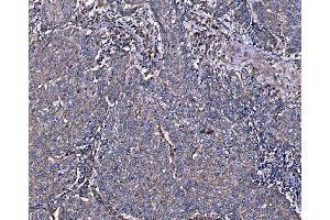 IHC analysis of Integrin Linked ILK using anti-Integrin Linked ILK antibody (ABIN7599411). (ILK 抗体  (AA 1-452))