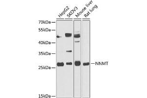 Western blot analysis of extracts of various cell lines, using NNMT antibody (ABIN6130587, ABIN6144695, ABIN6144697 and ABIN6218242) at 1:1000 dilution. (NNMT 抗体  (AA 1-264))