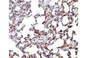 Immunohistochemistry (IHC) image for anti-SKI-Like Oncogene (SKIL) (N-Term) antibody (ABIN1031579)