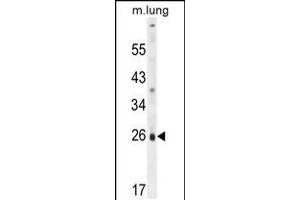 Western blot analysis in mouse lung tissue lysates (35ug/lane). (PQLC1 抗体  (AA 100-128))