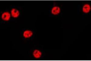 ABIN6275634 staining HepG2 by IF/ICC. (TCEAL1 抗体  (Internal Region))