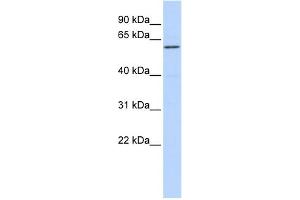 WB Suggested Anti-ZNF165 Antibody Titration:  0. (ZNF165 抗体  (Middle Region))