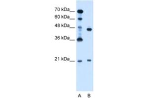 Western Blotting (WB) image for anti-Ubiquitin-Conjugating Enzyme E2E 2 (UBE2E2) antibody (ABIN2462697) (UBE2E2 抗体)