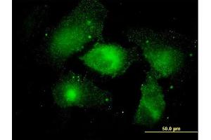 Immunofluorescence of monoclonal antibody to MARCKS on HeLa cell.