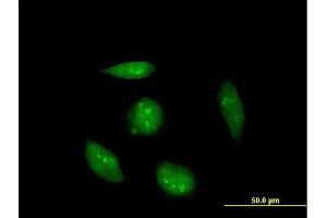 Immunofluorescence of purified MaxPab antibody to RAG2 on HeLa cell. (RAG2 抗体  (AA 1-527))