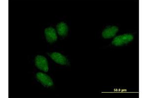Immunofluorescence of purified MaxPab antibody to SSU72 on HeLa cell. (SSU72 抗体  (AA 1-194))