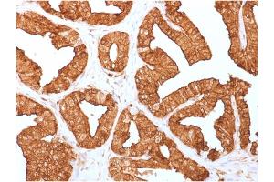 Formalin-fixed, paraffin-embedded human Prostate tissue stained with Annexin A1 Mouse Monoclonal Antibody (ANXA1/1671). (Annexin a1 抗体)