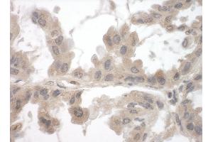 anti-Formin Binding Protein 1-Like (FNBP1L) (AA 450-500) antibody