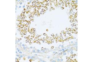 Immunohistochemistry of paraffin-embedded rat testis using DVL1 antibody (ABIN7266796) at dilution of 1:100 (40x lens). (DVL1 抗体  (AA 510-640))