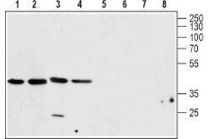 Western blot analysis of rat brain (lanes 1 and 5), mouse brain (lanes 2 and 6), human U-87 MG brain glioblastoma cell line (lanes 3 and 7) and rat C6  brain glioma cell line (lanes 4 and 8) lysates: - 1-4. (CALHM1 抗体  (C-Term, Intracellular))