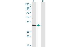 Western Blot analysis of ZNF101 expression in transfected 293T cell line by ZNF101 monoclonal antibody (M01), clone 2D5. (ZNF101 抗体  (AA 112-201))
