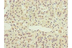 Immunohistochemistry (IHC) image for anti-Protein Phosphatase 2A 48 KDa Regulatory Subunit (PPP2R3B) (AA 356-575), (Regulatory Subunit B) antibody (ABIN7169282)