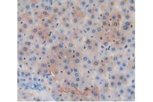 Figure. (GSTA4 抗体  (AA 2-222))