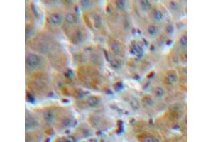 Used in DAB staining on fromalin fixed paraffin-embedded Liver tissue (MBL2 抗体  (AA 42-96))