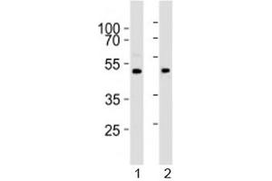 Western blot analysis of lysate from 1) human brain and 2) mouse brain tissue lysate using PRMT8 antibody at 1:1000. (PRMT8 抗体  (AA 344-373))