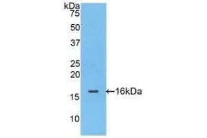Detection of Recombinant FABP4, Mouse using Polyclonal Antibody to Fatty Acid Binding Protein 4 (FABP4) (FABP4 抗体  (AA 2-132))