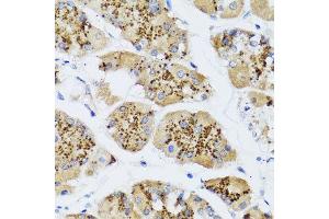 Immunohistochemistry of paraffin-embedded human gastric using CHIC2 antibody at dilution of 1:100 (x40 lens). (CHIC2 抗体)
