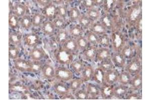 IHC-P analysis of Rat Kidney Tissue, with DAB staining. (CAMK2A 抗体  (AA 1-478))