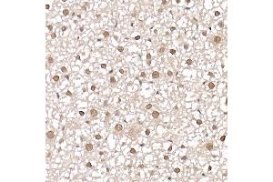 Immunohistochemistry of paraffin-embedded mouse liver using [KO Validated] PRMT4/C Rabbit pAb (ABIN1682307, ABIN3015886, ABIN3015887 and ABIN6219468) at dilution of 1:25 (40x lens). (CARM1 抗体  (AA 409-608))