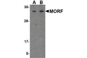 Western Blotting (WB) image for anti-Mortality Factor 4 (MORF4) antibody (ABIN2475740) (MORF4 抗体)