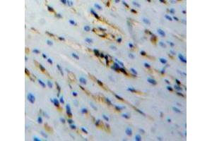 Used in DAB staining on fromalin fixed paraffin-embedded stomach tissue (PCOLCE2 抗体  (AA 154-269))