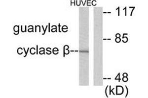 Western blot analysis of extracts from HuvEc cells, using Guanylate Cyclase beta Antibody. (GUCYB 抗体  (AA 10-59))