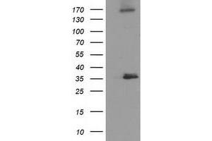 Western Blotting (WB) image for anti-Nudix (Nucleoside Diphosphate Linked Moiety X)-Type Motif 6 (NUDT6) antibody (ABIN1499864) (NUDT6 抗体)