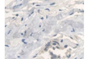 Immunohistochemistry (IHC) image for anti-Anthrax Toxin Receptor 2 (ANTXR2) (AA 34-318) antibody (ABIN7435958)