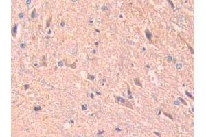 IHC-P analysis of Rat Spinal cord Tissue, with DAB staining.