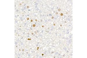 Immunohistochemistry of paraffin-embedded mouse liver using [KO Validated] CDKN1A/p21CIP1 Rabbit mAb (ABIN7266599) at dilution of 1:100 (40x lens). (p21 抗体)