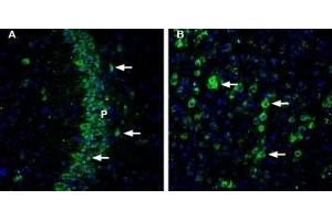 Expression of CHERP in mouse brain - Immunohistochemical staining of mouse brain sections using Anti-CHERP Antibody (ABIN7043011, ABIN7044119 and ABIN7044120). (CHERP 抗体  (Cytosolic))