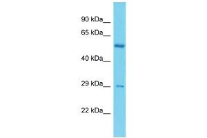 Host: Rabbit Target Name: C19orf66 Sample Type: ACHN Whole cell lysates Antibody Dilution: 1. (C19ORF66 抗体  (N-Term))