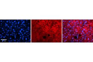 Rabbit Anti-Pard6b Antibody    Formalin Fixed Paraffin Embedded Tissue: Human Adult liver  Observed Staining: Cytoplasmic,Membrane Primary Antibody Concentration: 1:600 Secondary Antibody: Donkey anti-Rabbit-Cy2/3 Secondary Antibody Concentration: 1:200 Magnification: 20X Exposure Time: 0. (PARD6B 抗体  (N-Term))