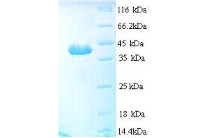SDS-PAGE (SDS) image for Apoptotic Peptidase Activating Factor 1 (APAF1) (AA 104-415) protein (His tag) (ABIN5713234)