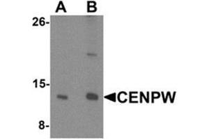 Western blot analysis of CENPW in HeLa cell lysate lysate with CENPW Antibody  at (A) 0. (CENPW 抗体  (N-Term))