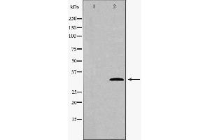 Western blot analysis of extracts of hela , using CDK4 antibody. (CDK4 抗体  (Internal Region))
