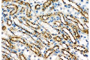 Anti-Cathepsin D Picoband antibody,  IHC(P): Mouse Kidney Tissue (Cathepsin D 抗体  (AA 65-410))