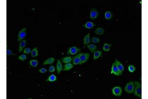 Immunofluorescent analysis of PC-3 cells using ABIN7172957 at dilution of 1:100 and Alexa Fluor 488-congugated AffiniPure Goat Anti-Rabbit IgG(H+L) (TMIGD2 抗体  (AA 23-150))