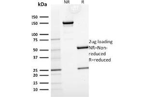 SDS-PAGE Analysis Purified Cytokeratin 15 Mouse Monoclonal Antibody (KRT15/2554). (KRT15 抗体)