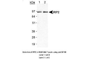 Image no. 2 for anti-Iron-Responsive Element Binding Protein 2 (IREB2) antibody (ABIN363497) (IREB2 抗体)