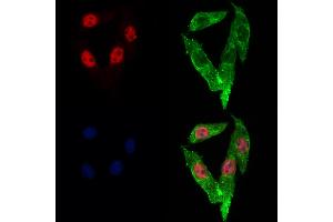 ABIN6262989 and ABIN6273053 staining Hela cells by IF/ICC. (Lamin B2 抗体  (Internal Region))