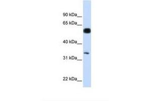 Image no. 1 for anti-BRISC and BRCA1 A Complex Member 1 (BABAM1) (AA 36-85) antibody (ABIN6749759) (BRISC and BRCA1 A Complex Member 1 (BABAM1) (AA 36-85) 抗体)