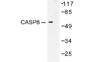 Image no. 1 for anti-Caspase 8 (CASP8) antibody (ABIN271875) (Caspase 8 抗体)