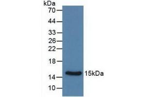 Detection of Recombinant Calcitonin, Rat using Monoclonal Antibody to Calcitonin (CT) (Calcitonin 抗体  (AA 85-116))