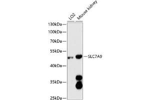 Western blot analysis of extracts of various cell lines, using SLC7 antibody (ABIN6130697, ABIN6148048, ABIN6148049 and ABIN6216625) at 1:3000 dilution. (SLC7A9 抗体  (AA 1-100))